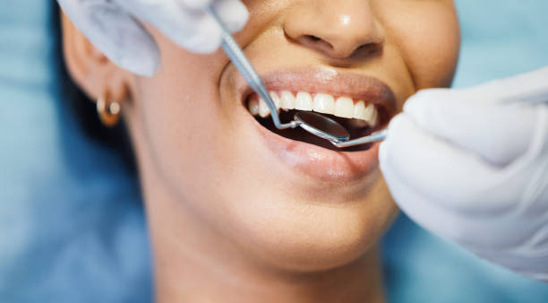 Best Emergency Dental Care for Broken or Chipped Teeth in Collinwood, TN